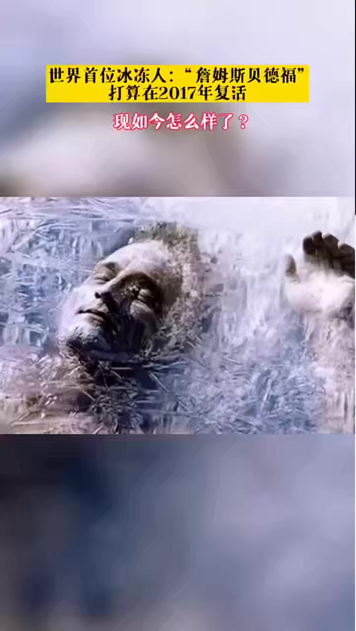 世界上第一个被冰冻的人,已经被冰冻了52年,如今冰冻已到期,还有希望