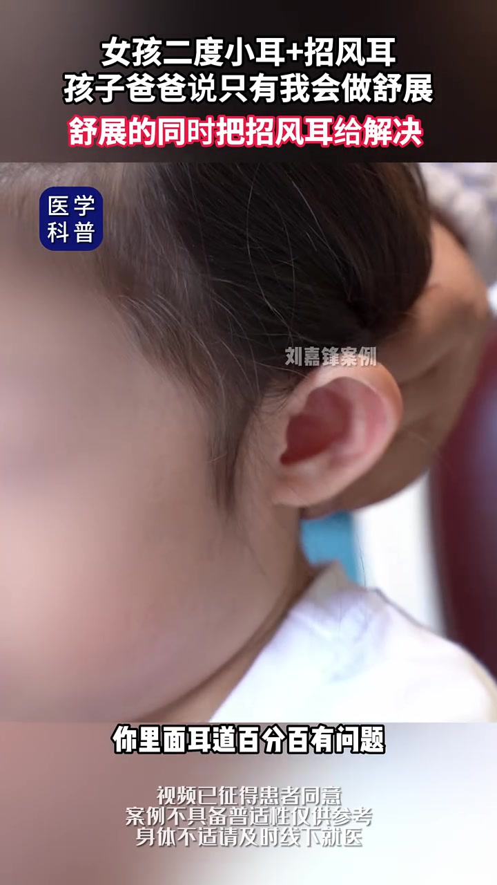 女孩二度小耳 招风耳,父母刷了我很多视频,孩子爸爸说只有我会舒展