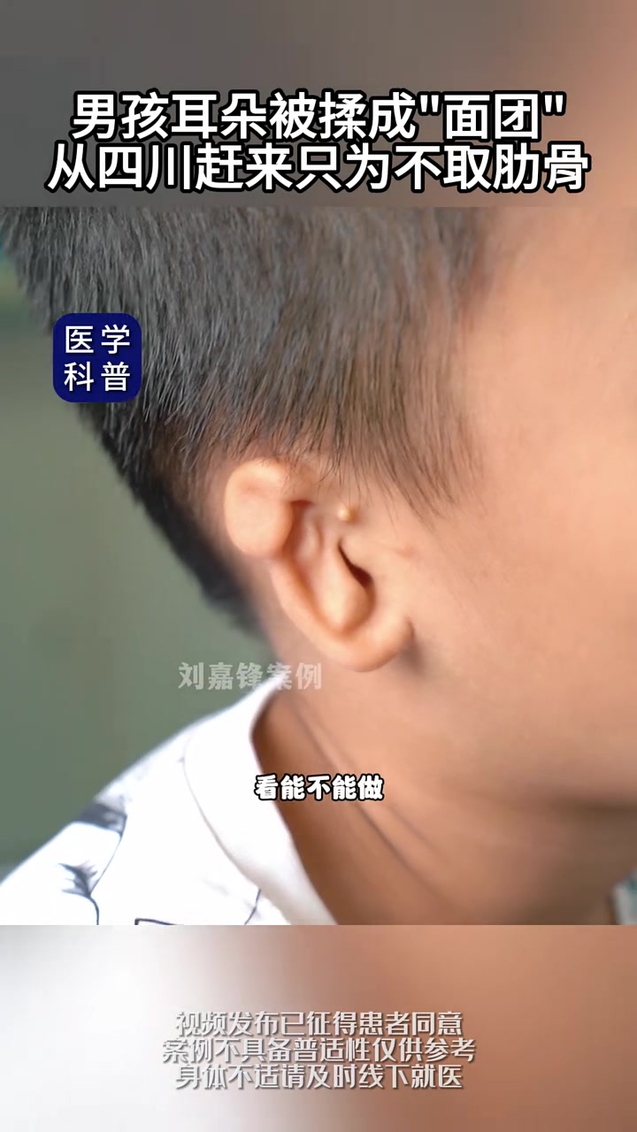 耳朵压扁会自己长好吗刚出生的婴儿耳朵畸形图片畸形耳朵遮发型小男生
