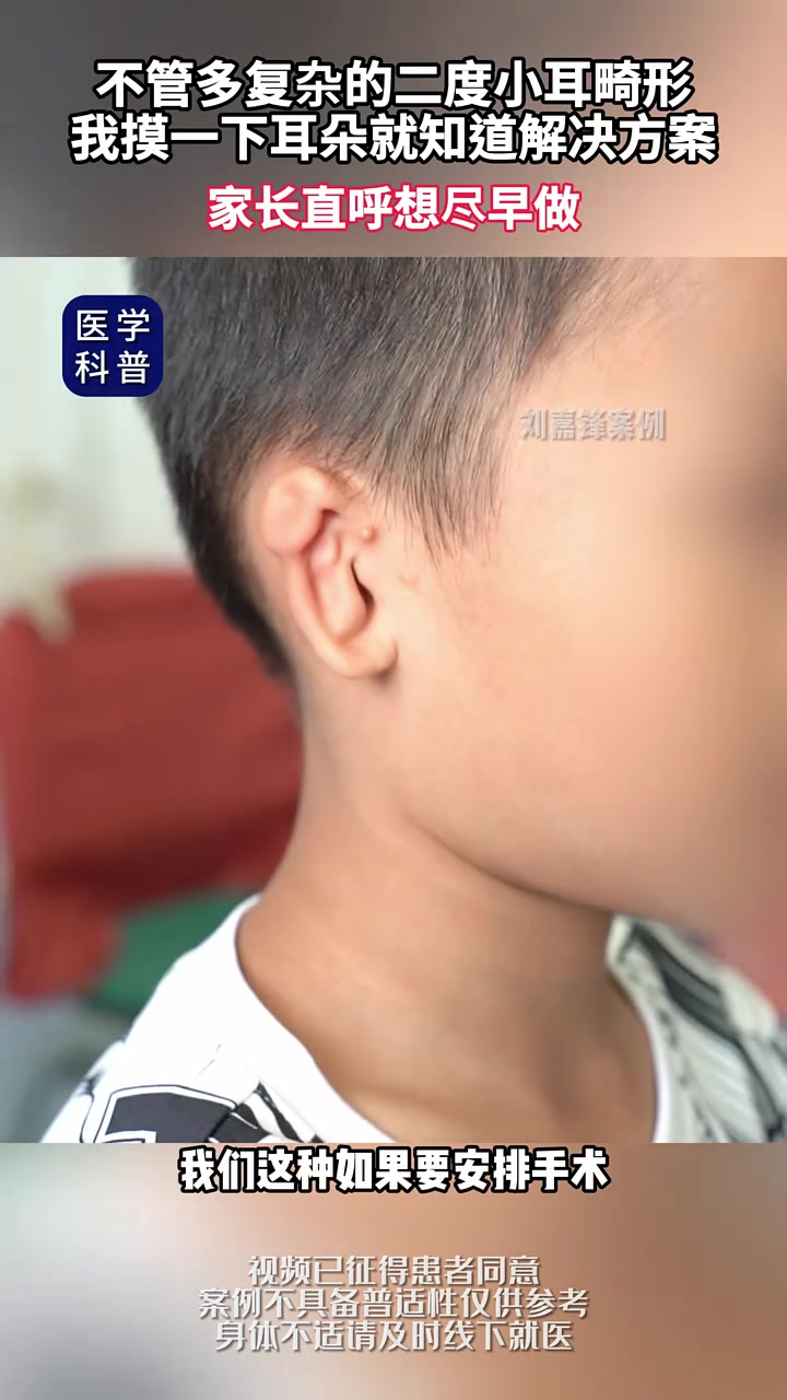 摸一下耳朵我就知道解决方案 小耳畸形 耳朵 刘嘉锋不取肋骨
