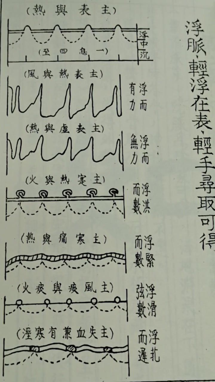 即可获得全套鬼脉在三指图解反关脉与斜飞脉位置图斜飞脉和反关脉的