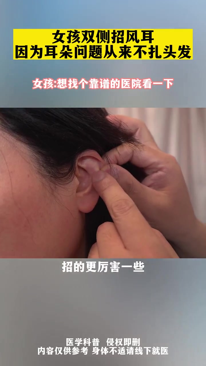 耳朵 招风耳