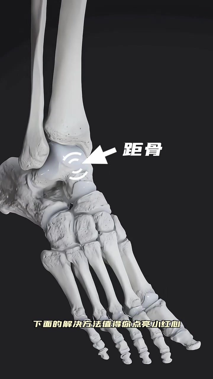 很多成人的腰膝痛,孩子跑不快跳不高和距骨半脱位,足背屈功能受限有关