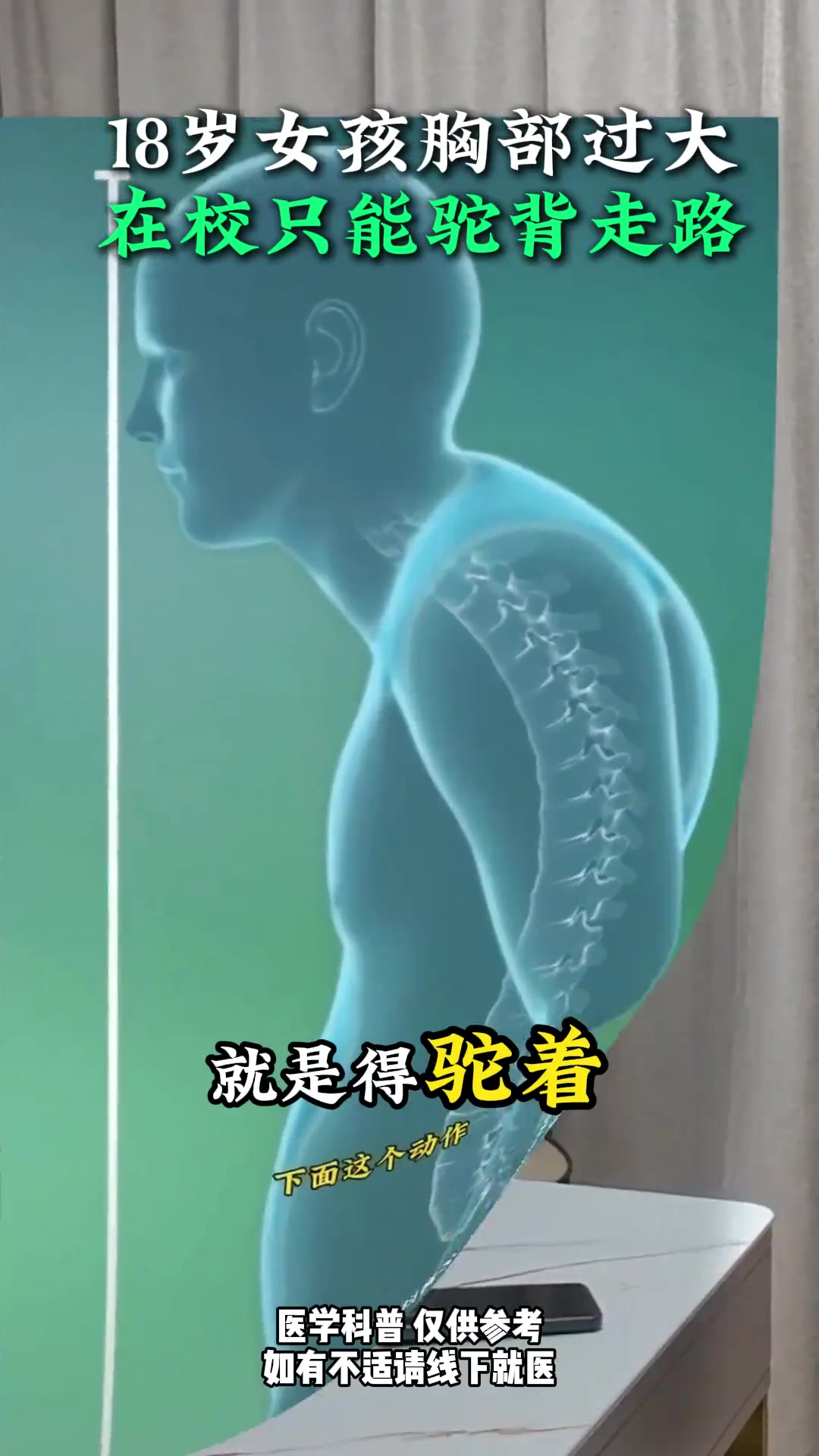 18岁女孩因发育问题导致驼背,长沙专家提供专业建议