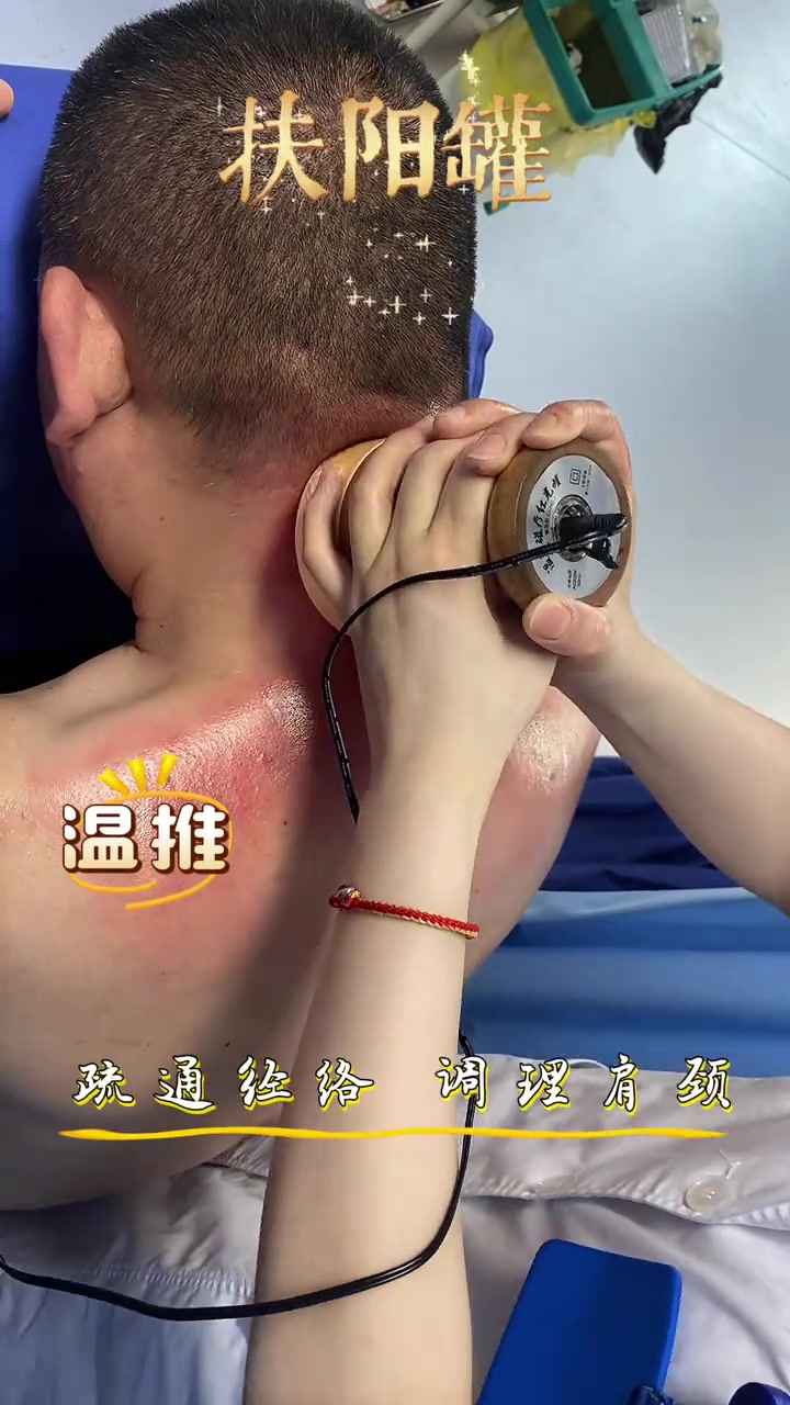 扶阳罐放松肩颈篇,有温度的推拿与无痛版刮痧