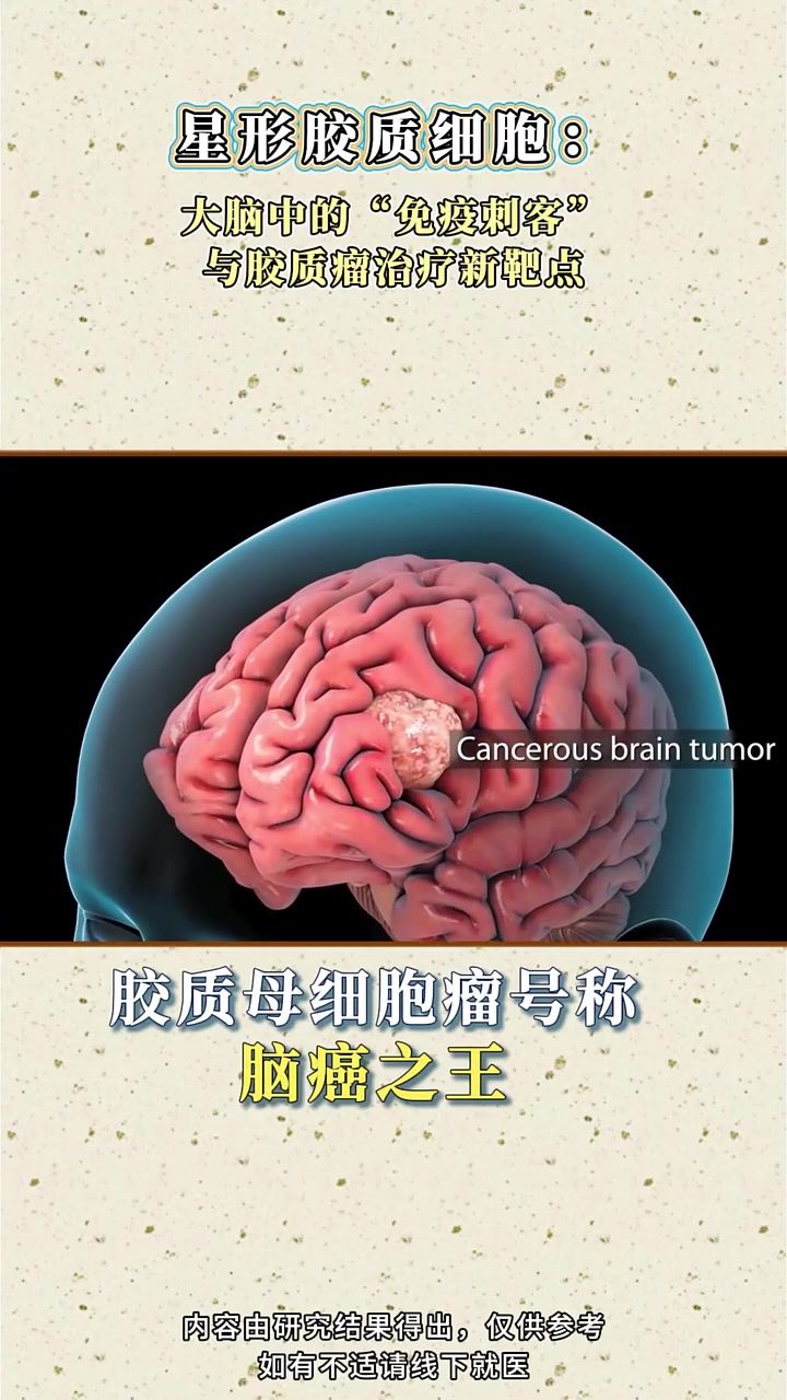 胶质瘤 医学科普