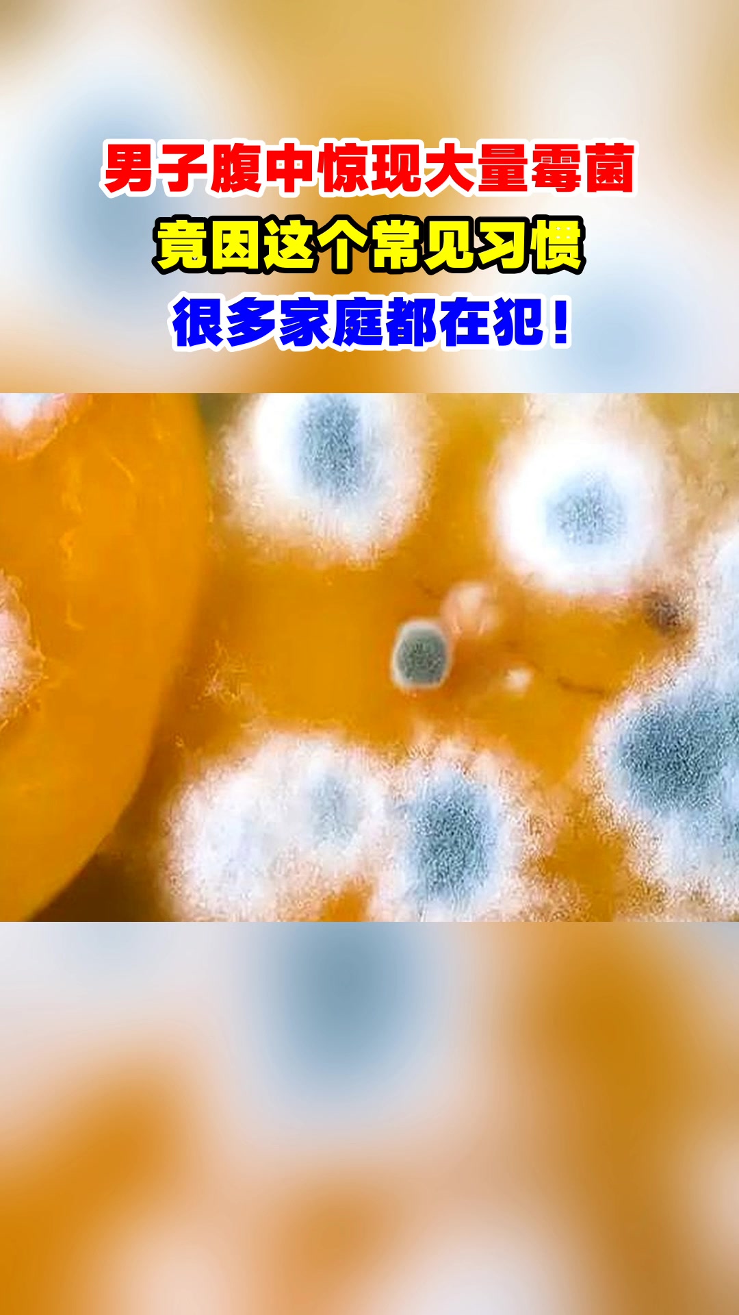 男子腹中惊现大量霉菌,竟因这个常见习惯,很多家庭都在犯!