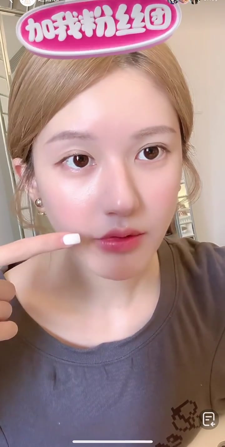 赵露思建议嘴凸的宝宝都去箍牙