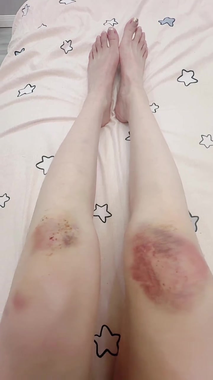 遛鹅狗三天腿受伤