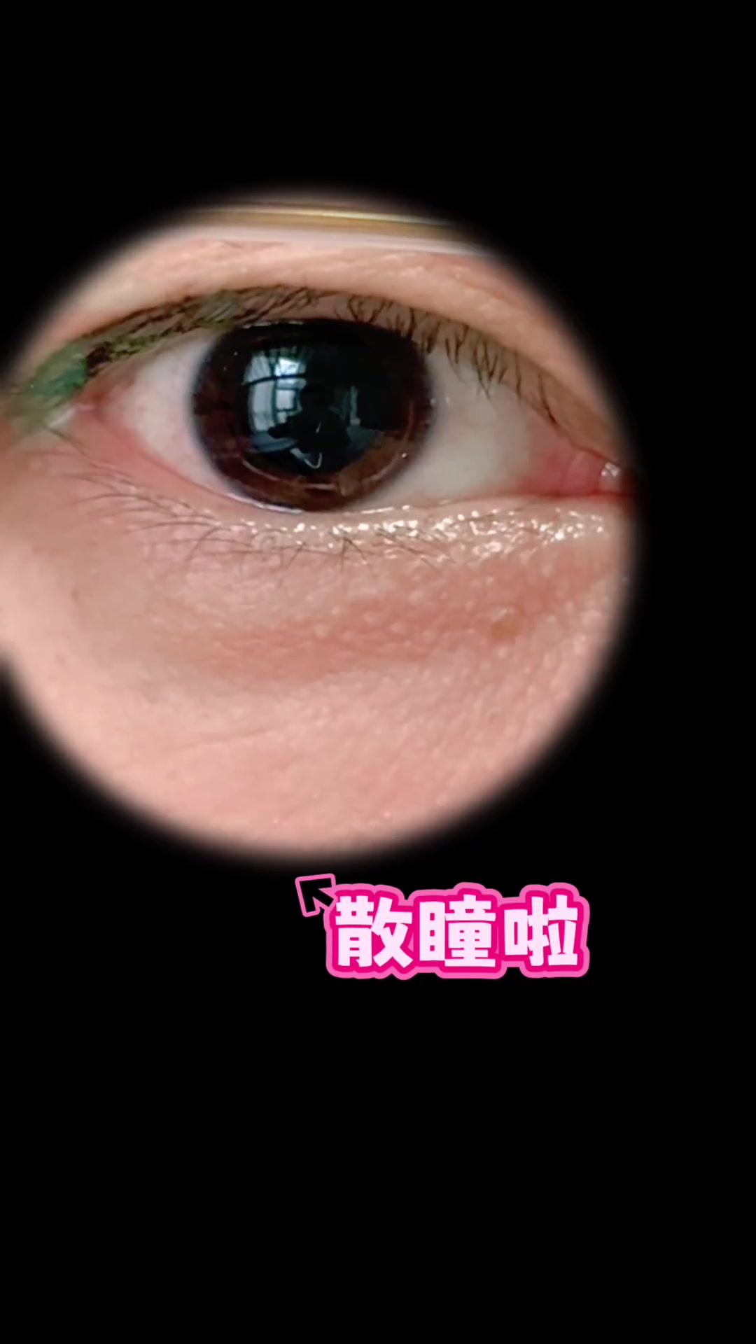 当眼前出现了飞蚊症 有黑影漂浮,甚至在光线暗的时候出现闪光感,及时