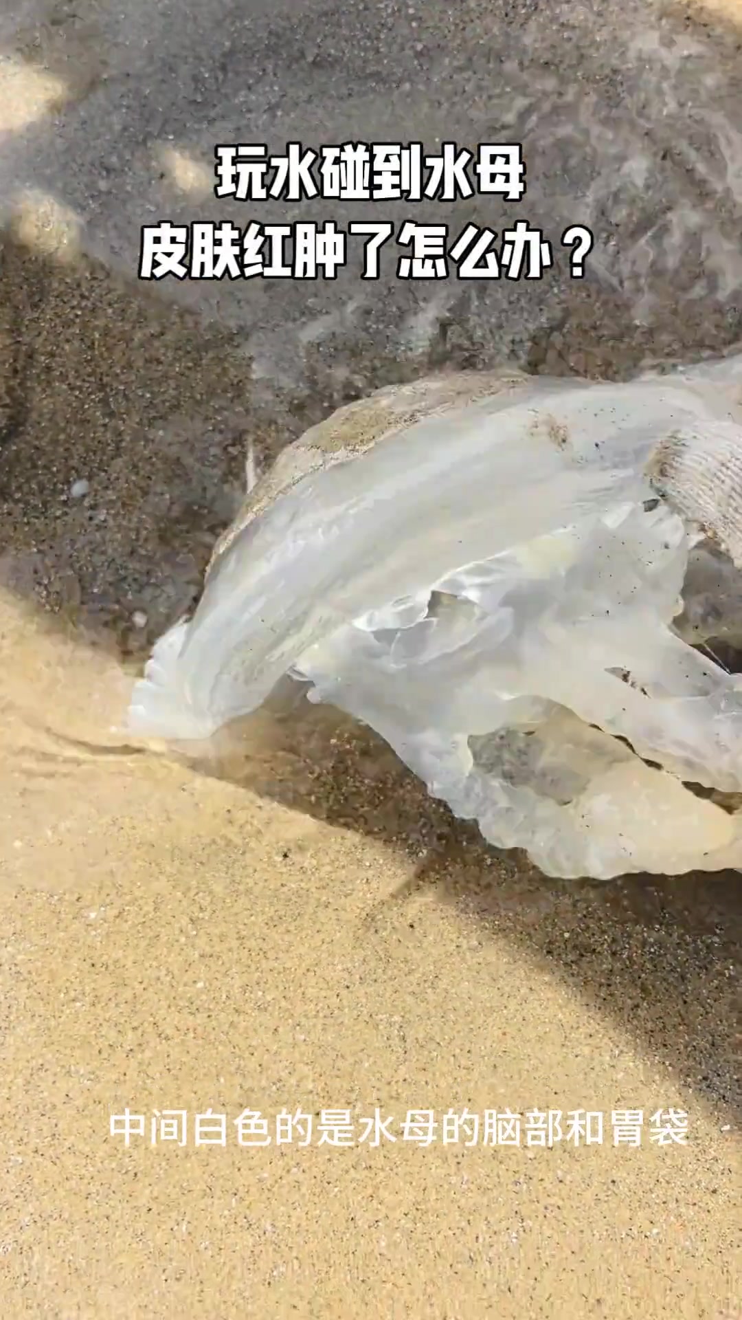 碰到有毒水母怎么办?