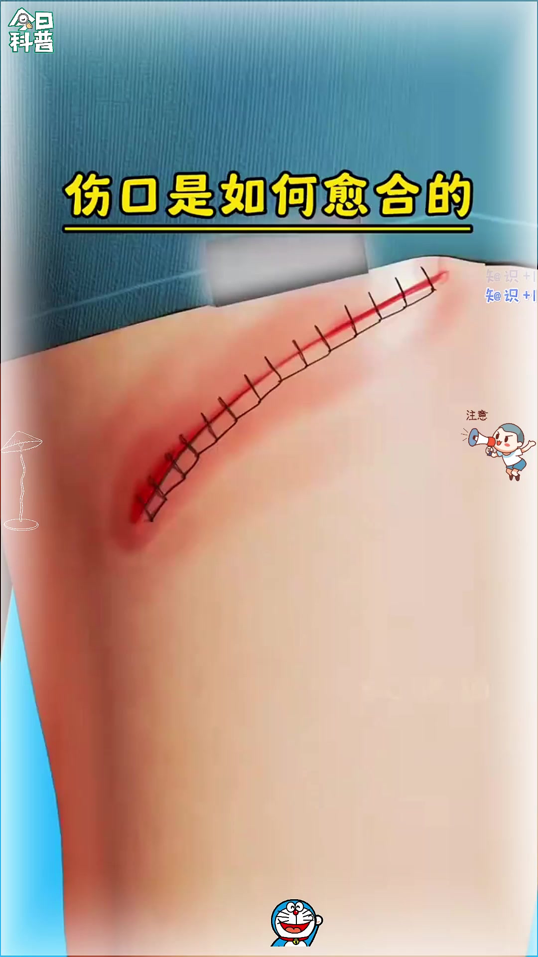 伤口愈合的全过程
